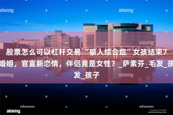 股票怎么可以杠杆交易 “狼人综合症”女孩结束7年婚姻，官宣新恋情，伴侣竟是女性？_萨素芬_毛发_孩子